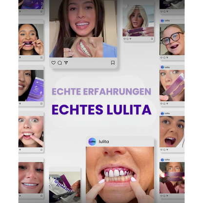 Hismile Zahnaufhellung